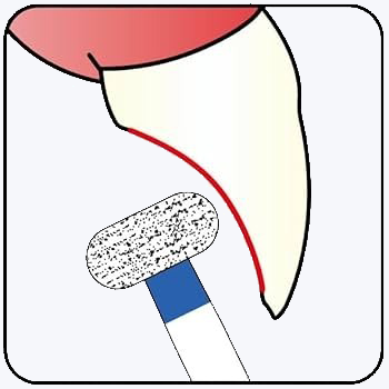 Mani Diamond Burs - Wheel Round Edge / Wr Series